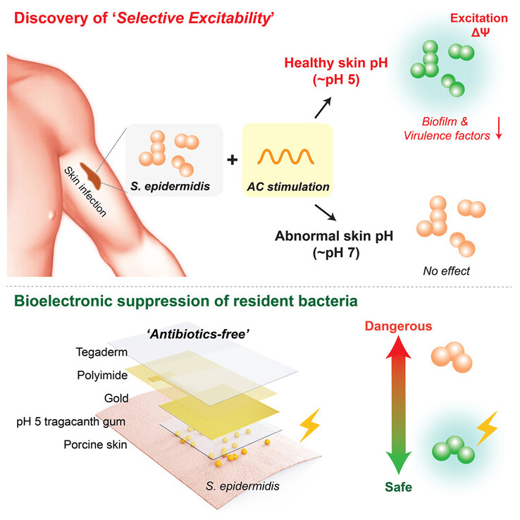 Représentation de la manière dont les signaux électriques peuvent déclencher ou "exciter" S. epidermidis. (Source de l'image : Device)