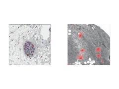 Organisation spatiale et tissulaire de la sénescence cellulaire (processus au cours duquel les cellules endommagées ou vieillissantes cessent de se diviser mais restent actives). (Source de l&#039;image : The Lancet Digital Health)