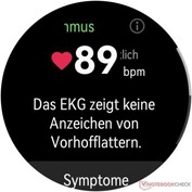 Résultat Fonction ECG