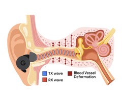 L&#039;APG utilise des tonalités ultrasoniques modulées par les changements de pression dans le canal auditif (Image Source : Google Research)