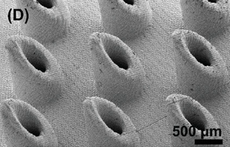 Image de microscopie électronique à balayage (MEB) d'un réseau de micro-aiguilles imprimé en 3D. (Source de l'image : Advanced Healthcare Materials)