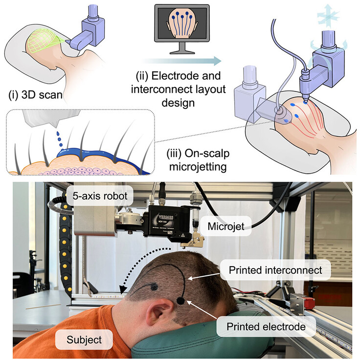 Un microjet monté sur un bras robotisé pulvérise un matériau conducteur biocompatible sur le cuir chevelu pour former des connexions électriques, en remplacement d'un capuchon EEG. (Source de l'image : Vasconcelos et al. dans Cell Biomaterials)